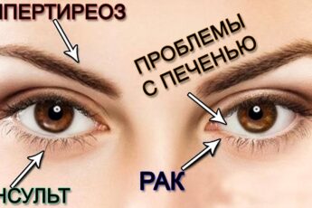 10 ВЕЩЕЙ, КОТОРЫЕ ВАШИ ГЛАЗА ПЫТАЮТСЯ РАССКАЗАТЬ ВАМ О ВАШЕМ ЗДОРОВЬЕ