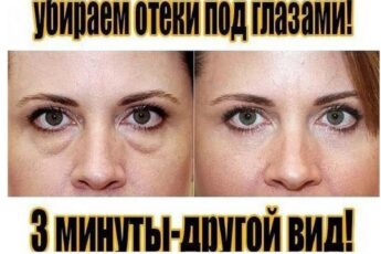Эта ДОМАШНЯЯ МАСКА быстро избавит от мешков под глазами