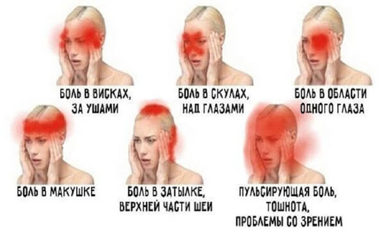О чем говорит боль в разных частях головы? 5 Предупредительных Сигналов
