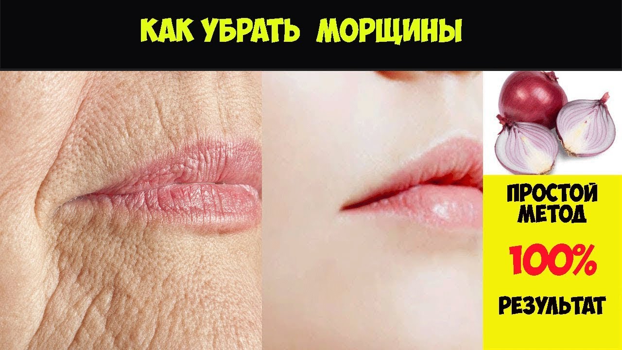 СУПЕР МАСКА ОТ МОРЩИН! Как убрать морщины на лице за 3 дня - Естественным Путем