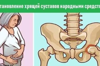 Восстановление хрящей суставов народными средствами