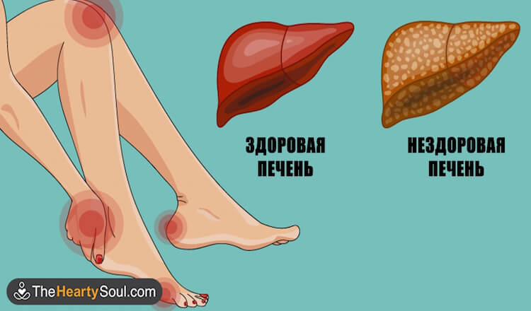 Вот как ваше тело демонстрирует что ваша печень в опасности