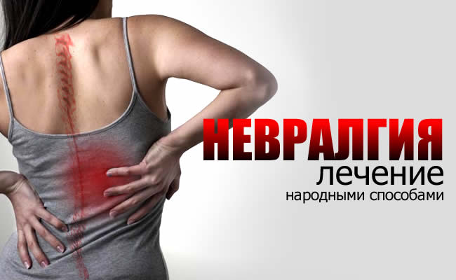 НЕВРАЛГИЯ: Причины, признаки, лечение народными способами