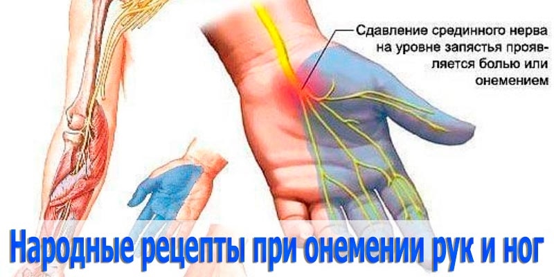 Народные рецепты против онемения рук и ног
