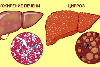 А что, если печень можно вылечить травами. 5 проверенных тысячами людей рецептов