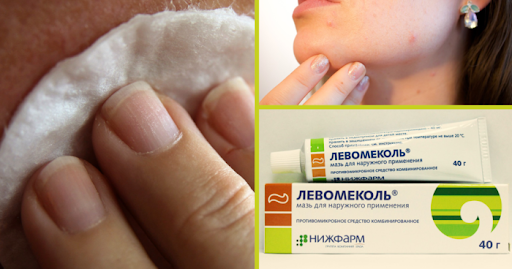 Эта мазь настоящая находка, но не все знают о её полезных свойствах