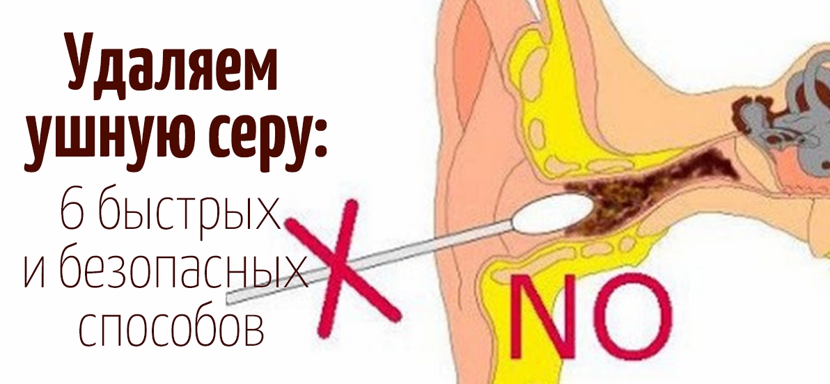 Как правильно чистить уши в домашних условиях