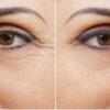 Убрать морщинки вокруг глаз можно и без косметолога. Помогут два простых продукта.