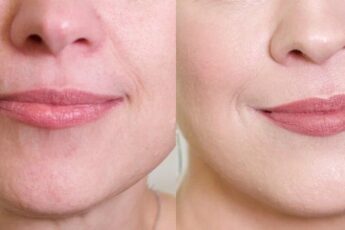 Рассказываю, какие 2 белорусских средства покупают клиентки 50 лет и старше после того, как видят свою кожу