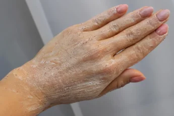 Мне уже скоро 50, а мои ручки выглядят как у 25-летней. И для этого даже не нужны дорогущие французские кремы. Делюсь своими секретами