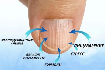 Почему на ваших ногтях появляются вертикальные полосы: 6 причин, о которых стоит знать