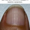 Если у вас бороздки на ногтях, вот что это говорит о вашем здоровье