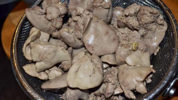 Почему суставы реагируют на питание после 60 лет. 7 продуктов для снижения мочевой кислоты