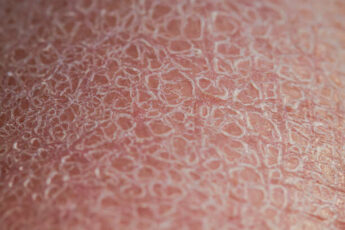 Голени как индикатор возраста: 5 изменений, которые вы зря списываете на усталость